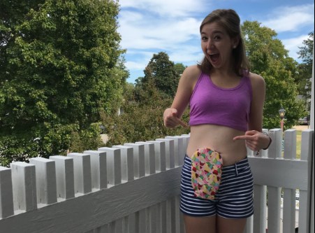 William & Mary graduate student Molly Atwater started the Instagram account @MollyOllyOstomy to share her experiences and daily life after her ileostomy surgery. (Photo courtesy Molly Atwater)