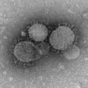 A MERS coronavirus shows its namesake crown-like structure under the microscope. (WYDaily/Courtesy CDC)