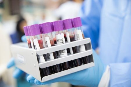 Quest Diagnostics is now testing for antibodies during the coronavirus (COVID-19) pandemic using blood samples. (WYDaily/ Courtesy of Pixabay)