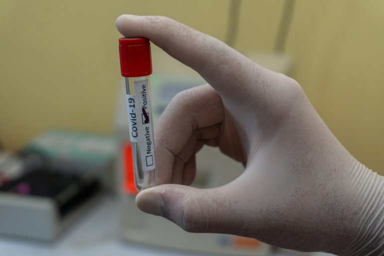 There will be free COVID-19 testing throughout the month of October for high-risk persons or those who do not have health insurance. (WYDaily file/Courtesy of Unsplash)